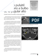 036 - Síndromes Vestibulares de Origen Vascular Insuficiencia Vértebro-Basilar, Migraña y Vértigo