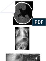 RA Imaging