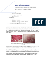 Tumores de La Mucosa Oral y Tumores Benignos Óseos