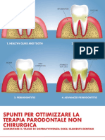 Terapia Parodontale