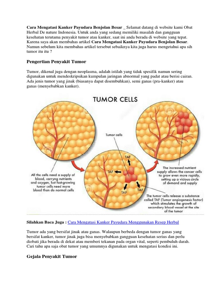 Hal Yang Bisa Menyebabkan Payudara Membesar - Berbagai Sebab