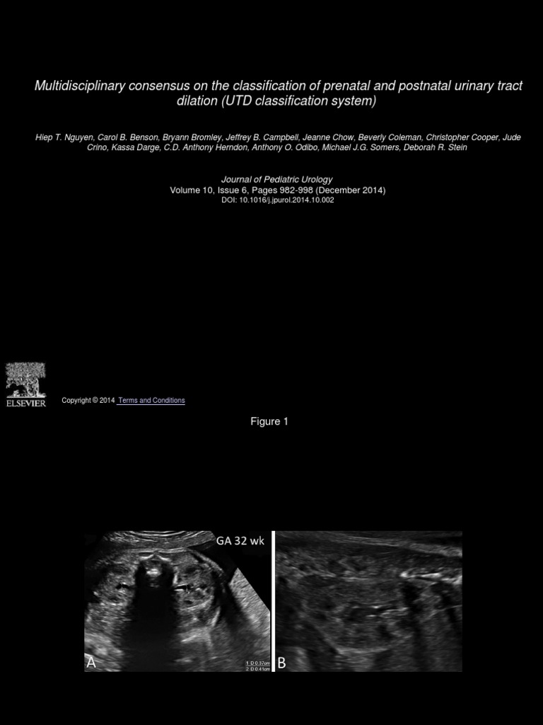 Multidisciplinary Consensus On The Classification of Prenatal and ...
