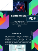 Epifisiolisis