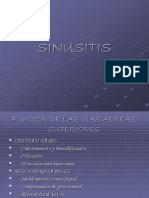 Sinusitis