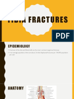 Tibia Fractures