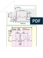 Ekg