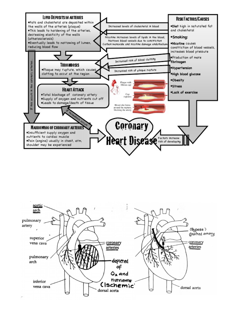 Risk Factors for Coronary Heart Disease | PDF | Atherosclerosis ...