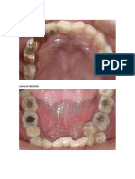 Intraoralmaxilar Sup y Inf