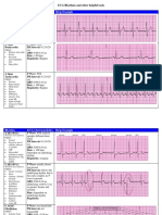 ECG Rhythms Guide