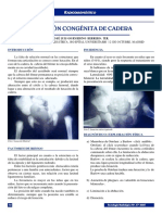 luxacioncongenita.pdf