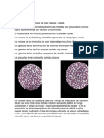 Resultados de Identificación de Células Inmunológicas