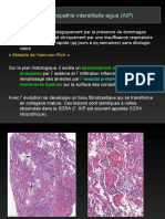 DU Thorax Pneumopathies Infiltrantes 02 HRM 2011FILEminimizer PDF