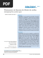 Tratamento de fissuras de lóbulo de orelha.pdf