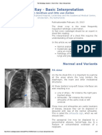 The Radiology Assistant Chest X Ray Basic Interpretation PDF