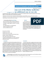 Aneurysmal Bone Cyst of the Fibular Malleolus Report of an Additional Case at Rare Site