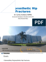 Periprosthetic Hip Fractures Dr. Arellano