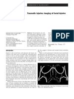 XXXXEpidemiological Study of Facial Fractures at The