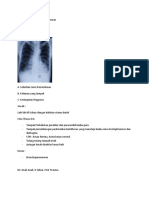 Tugas MPPD 1 (Tivano Radini Paembonan C014182155)