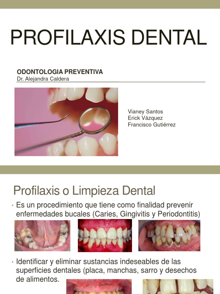 Protocolo de Profilaxis Dental Paso a Paso | PDF | Odontología | Ramas ...