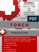 Torch (Kelompok 5)