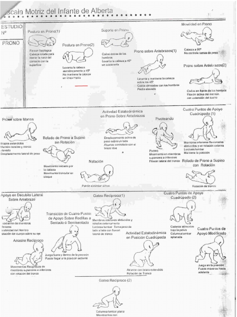 Escala de Alberta Testbddb | PDF