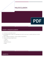 Aetiology of Malocclusion