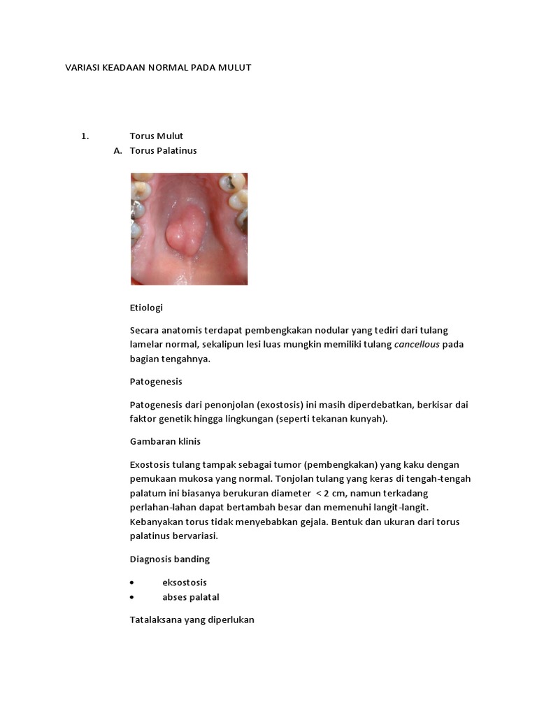 Torus Palatinus: Diagnosis dan Penyebab | PDF | Sains & Matematika