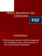 Penile Squamous Cell Carcinoma