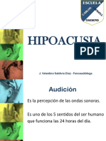 Hipoacusia