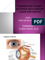 Pemeriksaan Segmen Anterior Mata Dengan Loupe Dan Senter