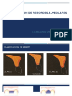 Clasificacion de Rebordes Alveolares Allen Seibert