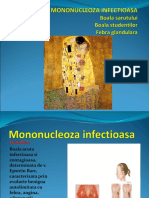Mononucleoza 2