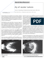 Ultrasonography of Ocular Tumors.