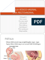 Fistula Vesico-Vaginal Dan Rectovaginal-1