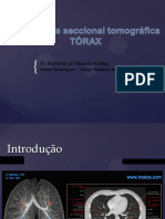 6-Aula TC de Torax - Anatomia PDF