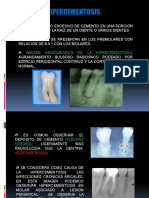 Hipercementosis y Anquilosis