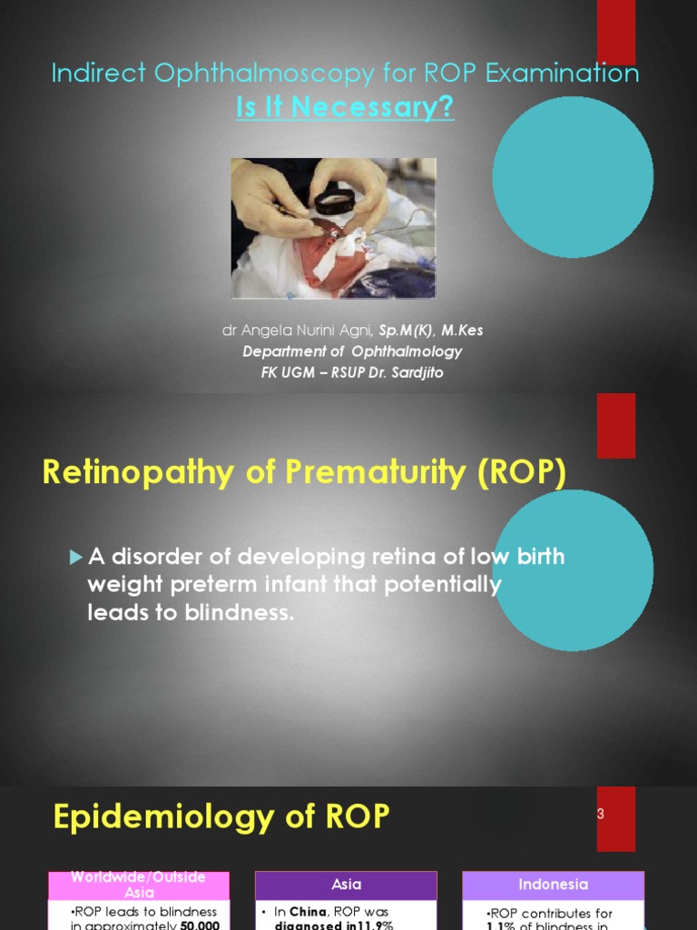Is Indirect Ophthalmoscopy Necessary for ROP Examination? A Review of