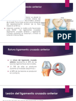 Ligamento Cruzado Anterior