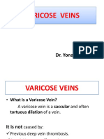 Varicose Veins: Dr. Yonas G. (MD)