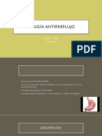 Cirugia Antirreflujo 4