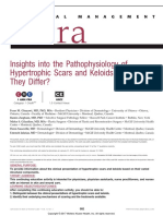 E Tra: Insights Into The Pathophysiology of Hypertrophic Scars and Keloids: How Do They Differ?