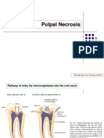 PPDGS Konservasi Lecture4a Pulp Necrotic