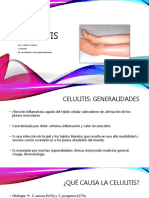 Celulitis 161217120714