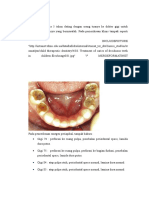 Perawatan Pedodontik