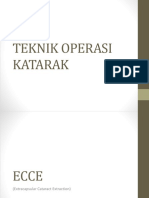 Teknik Operasi Katarak