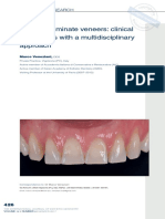 Ceramic Laminate Veneers