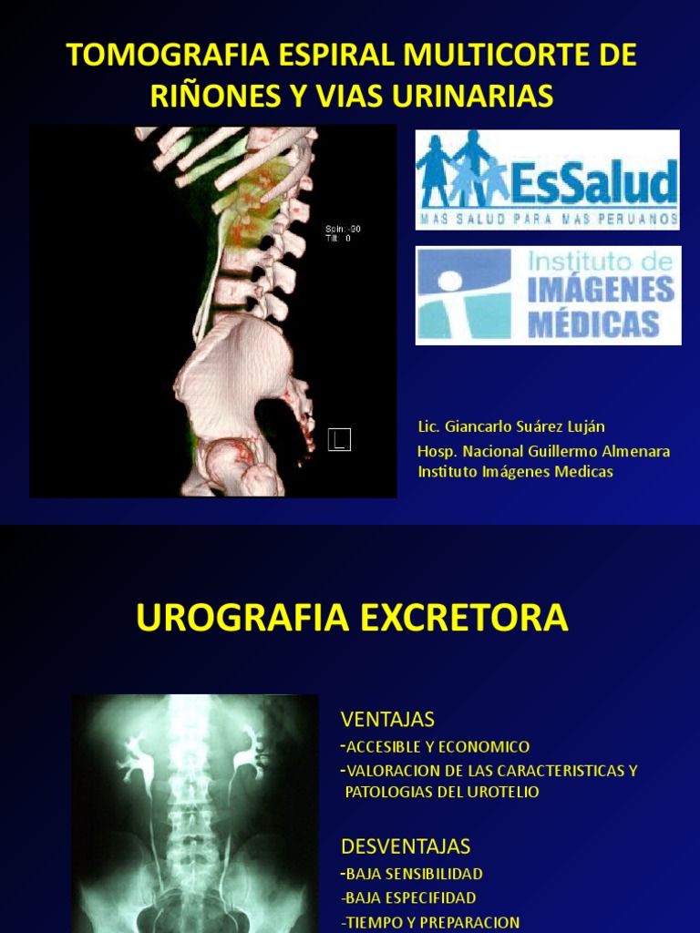 Tomografia Espiral Multicorte de Riñones y Vias Urinarias | PDF | Riñón ...