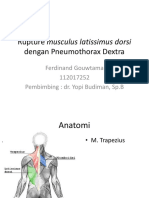 Rupture Musculus Latissimus Dorsi Dengan Pneumothorax Dextra