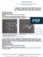 Drenagem biliar por CPER na prova do PSU 2014