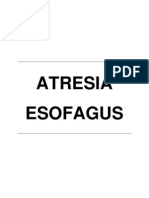 Atresia Esofagus (Kelainan Kongenital Esofagus)